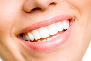 beautiful smile from our Colorado dentist