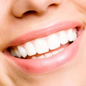 Smiling woman showcasing bright, white teeth, illustrating the aesthetic benefits of porcelain veneers for smile enhancement at Trail Ridge Dental.